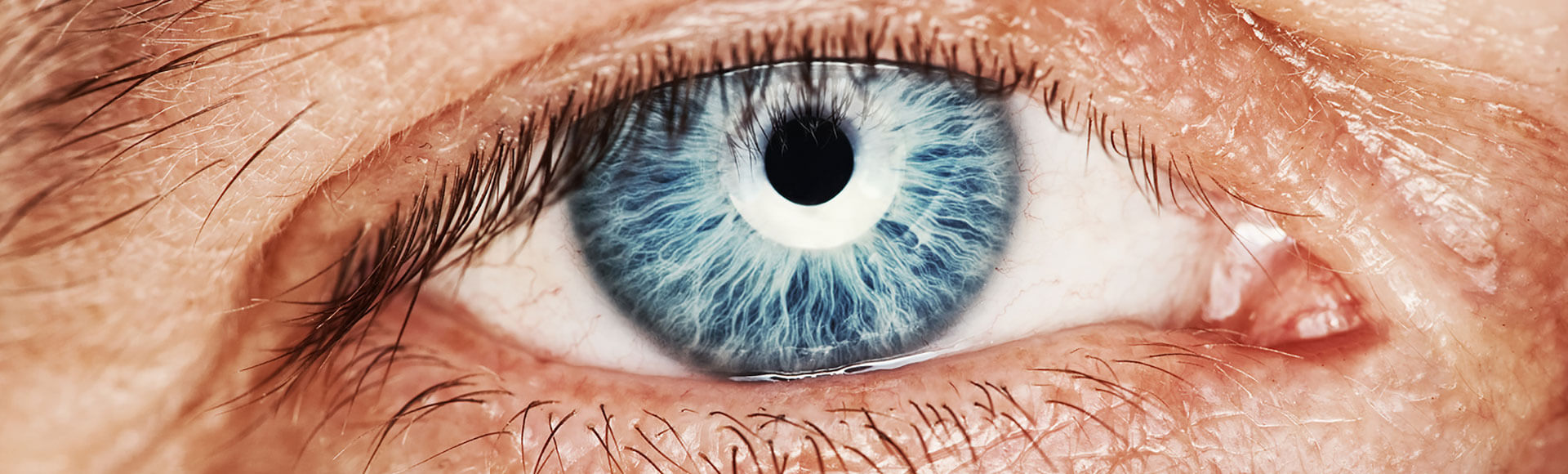 These Are Common Causes of Red Eye Eyedeology Blog