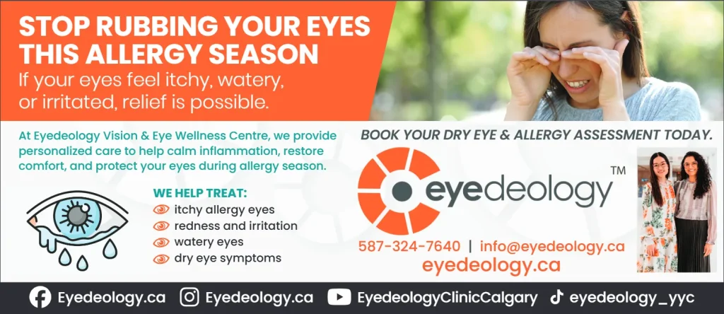 treat itchy eyes at eyedeology